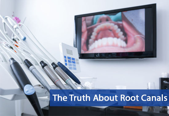 The Truth About Root Canals